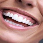 What is a Gingival Smile?