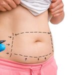What are the risks and dangers of liposuction?