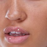 Four key questions that you must ask before injecting lip filler