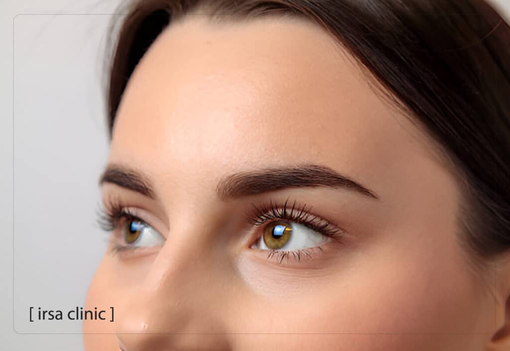 جراحی کاشت مژه طبیعی در شیراز
