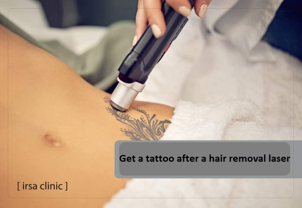  get a tattoo after a hair removal laser