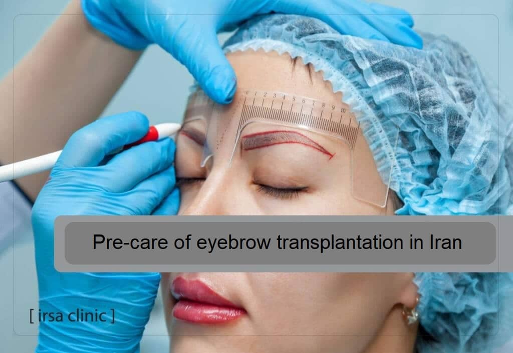 Pre-care of eyebrow transplantation in Shiraz (Iran)
