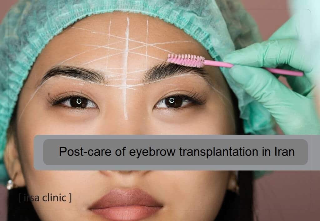 Post-care of eyebrow transplantation in Iran (Shiraz city)