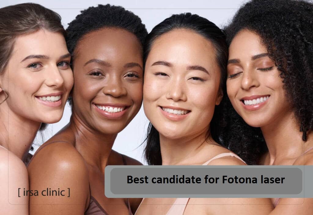 Best candidate for Fotona laser