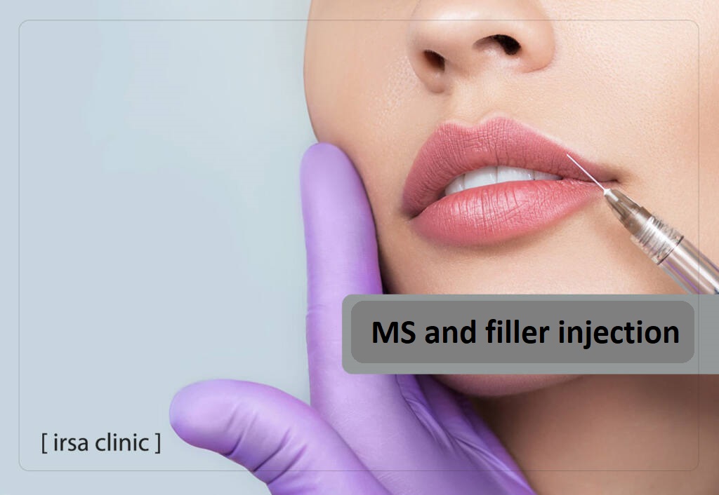 MS and filler injection 
