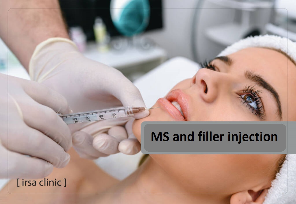 MS and filler injection 