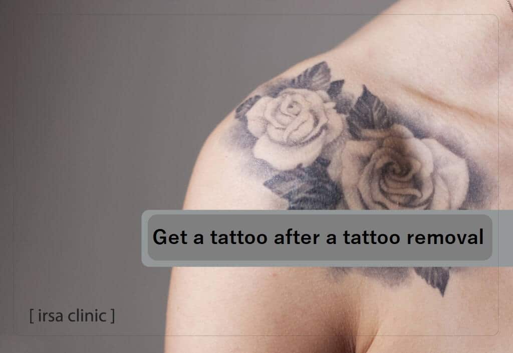 get a tattoo after a tattoo removal laser
