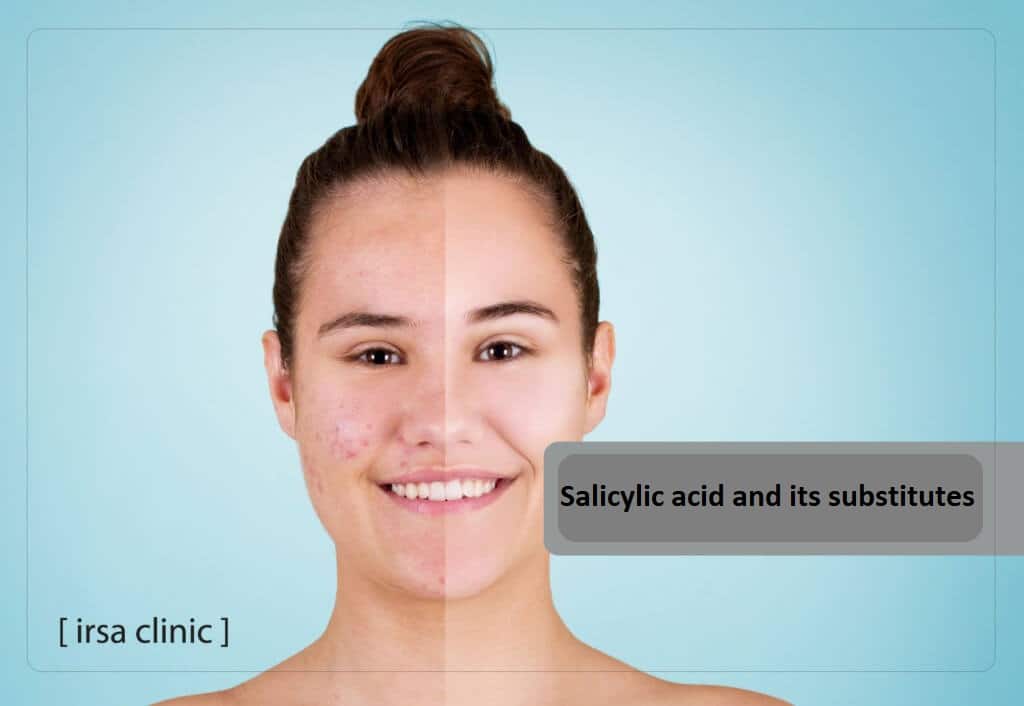 Salicylic acid 