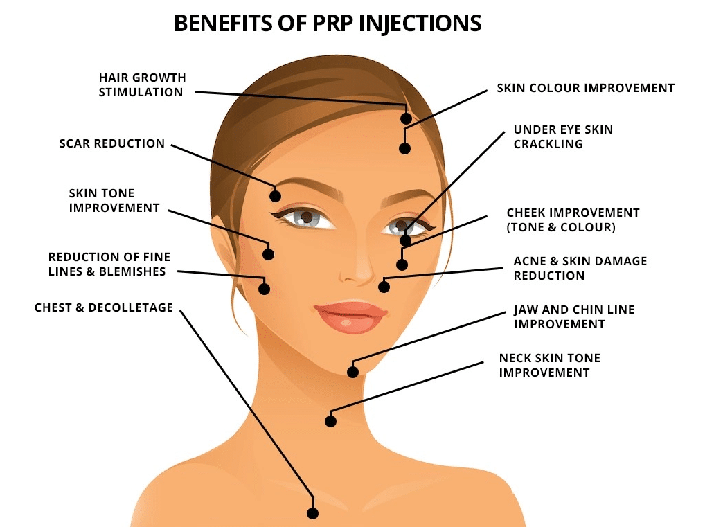 benefits of PRP injections in Iran