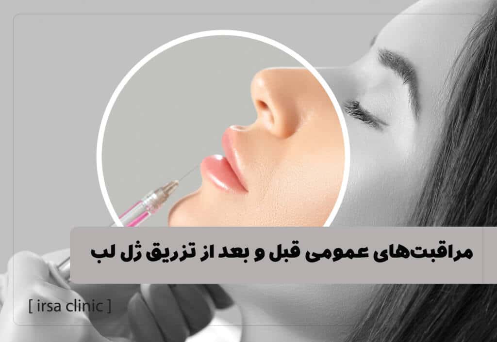 مراقبت‌های عمومی قبل و بعد از تزریق ژل لب