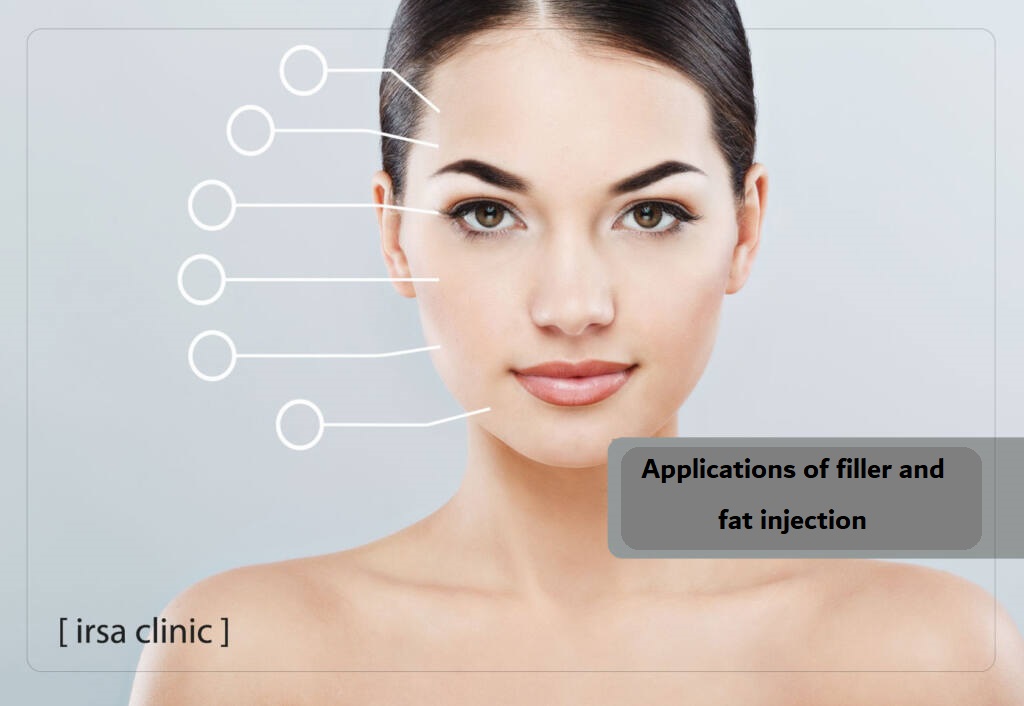 Applications of filler and fat injection