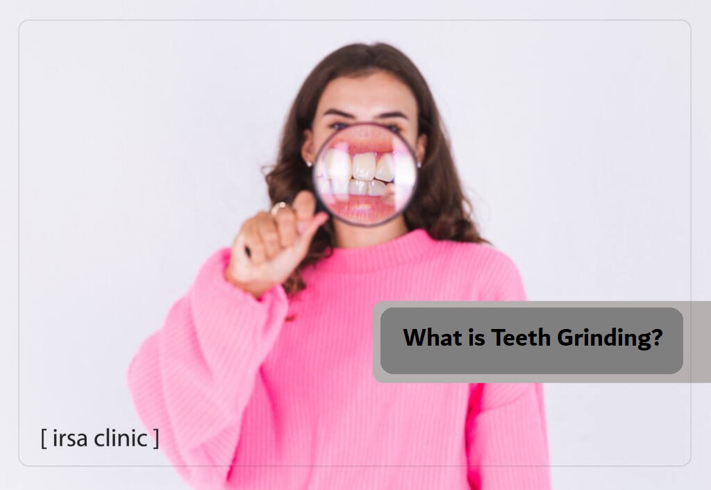 What is teeth grinding?