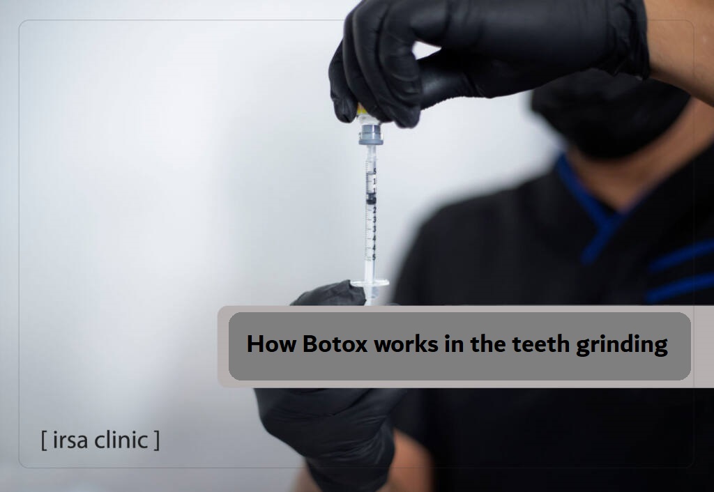 How Botox works in the teeth grinding treatment