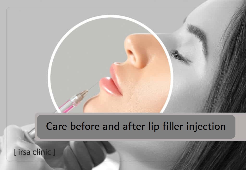 Care before and after lip filler injection at Irsa clinic in Shiraz