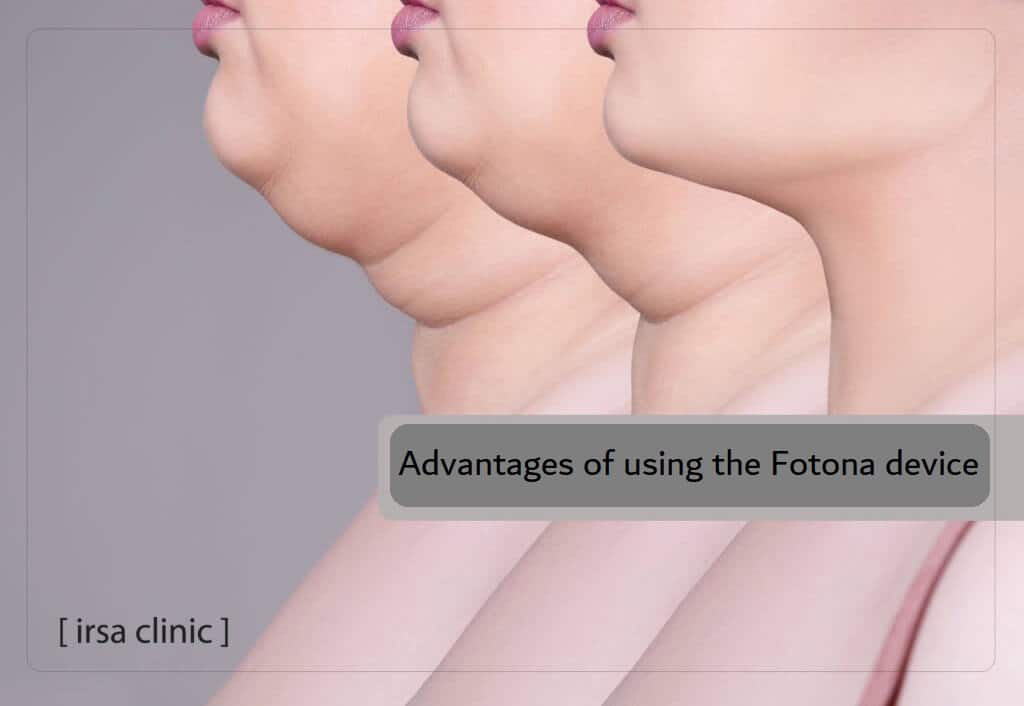 Advantages of using the Fotona device