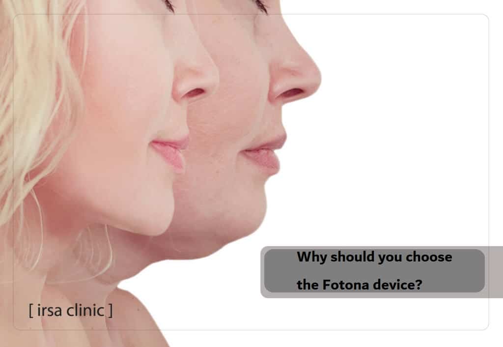 Why should you choose the Fotona device?