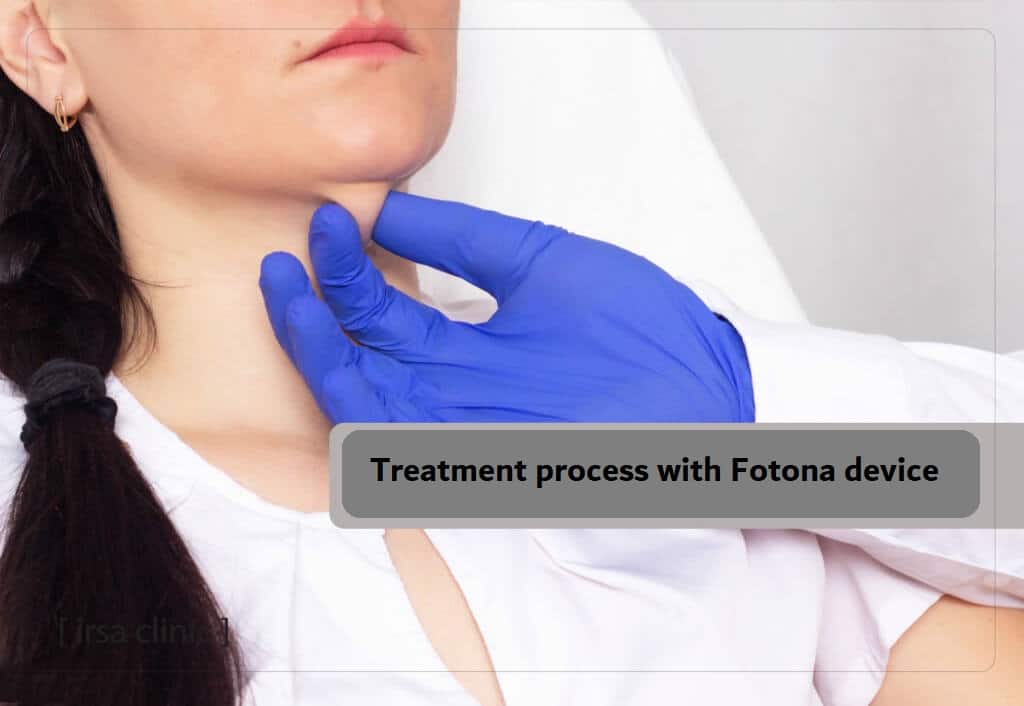 Treatment process with Fotona device