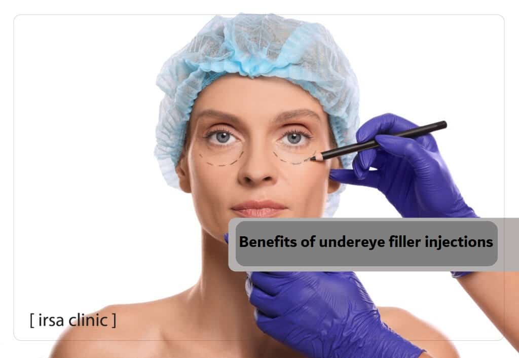 Benefits of filler injections under the eyes in Iran