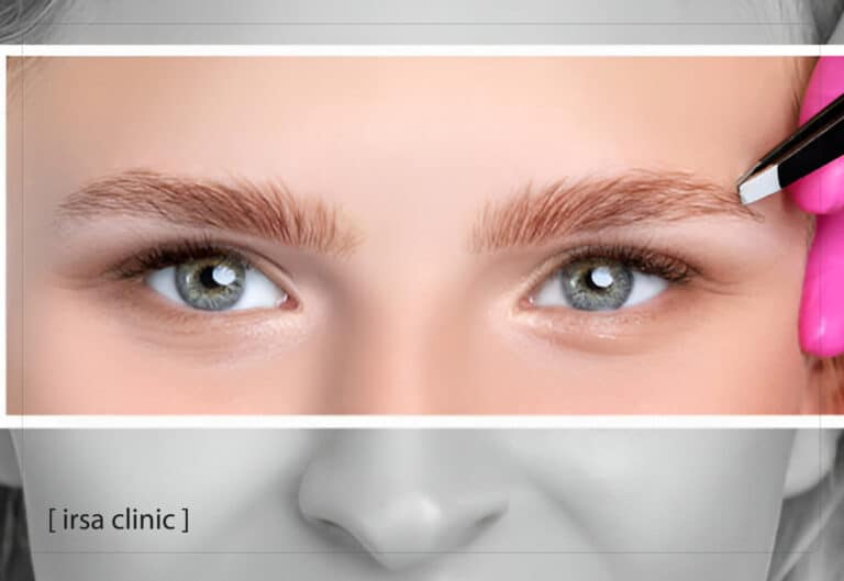 eyebrow transplantation in Iran (Shiraz city )