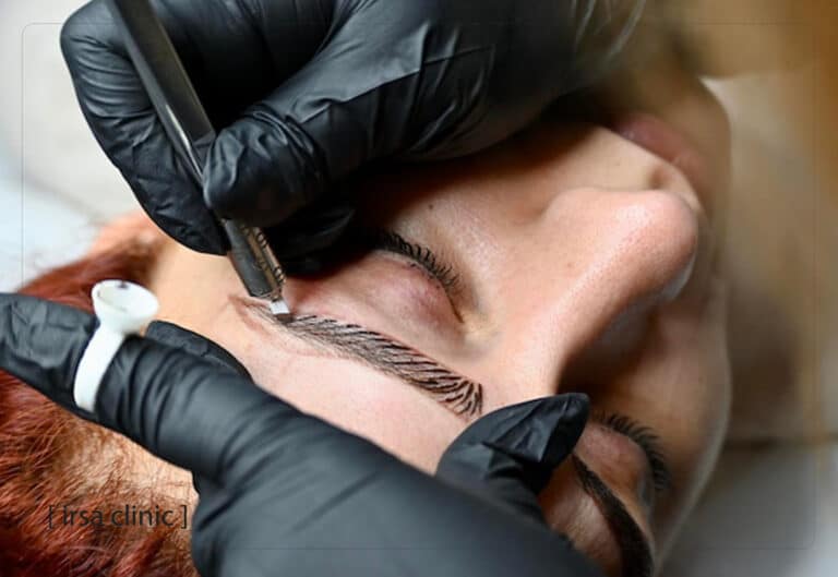 Eyebrow tattoo (micropigmentation)