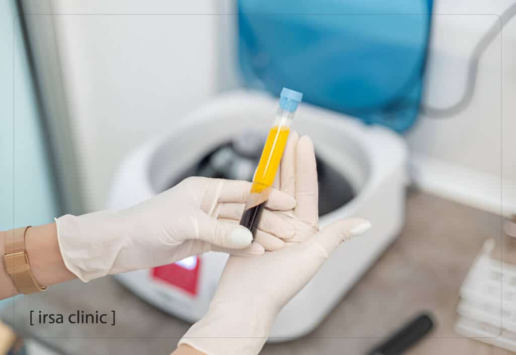 Platelet-Rich Plasma (PRP) Injections