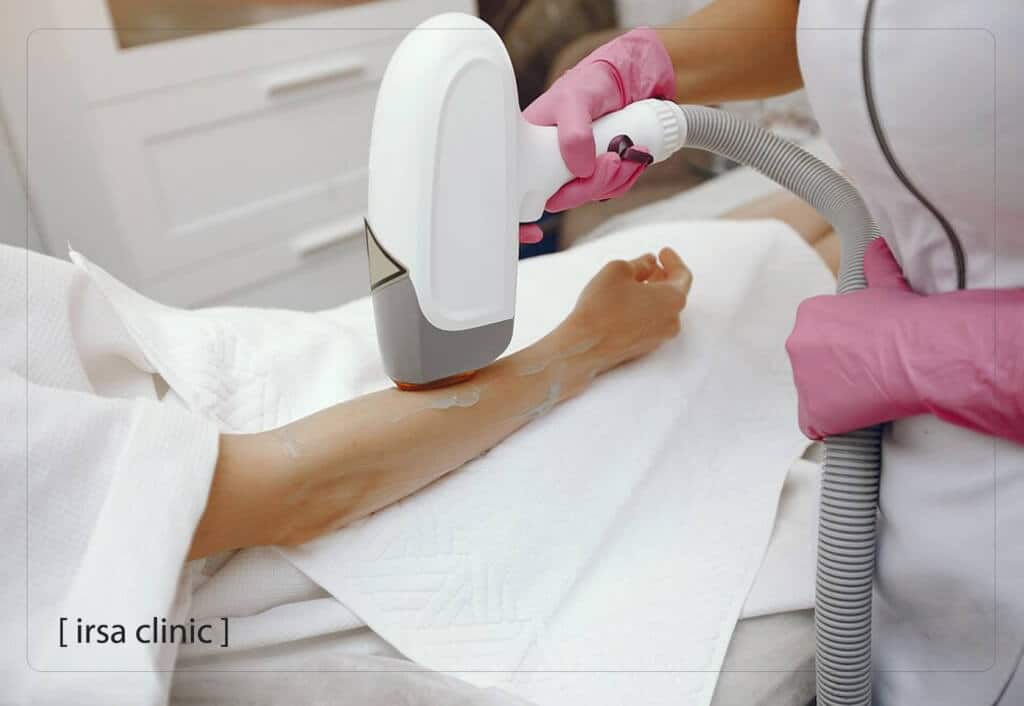 How does laser hair removal work