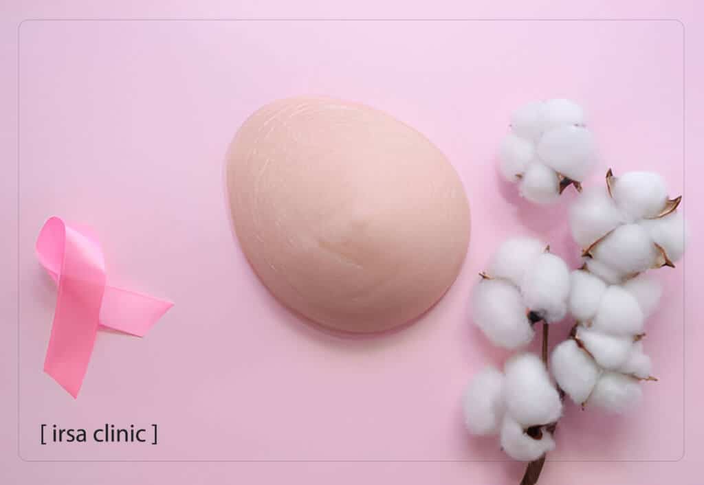 Why are breast implants a better option than fat transfer to the breast?