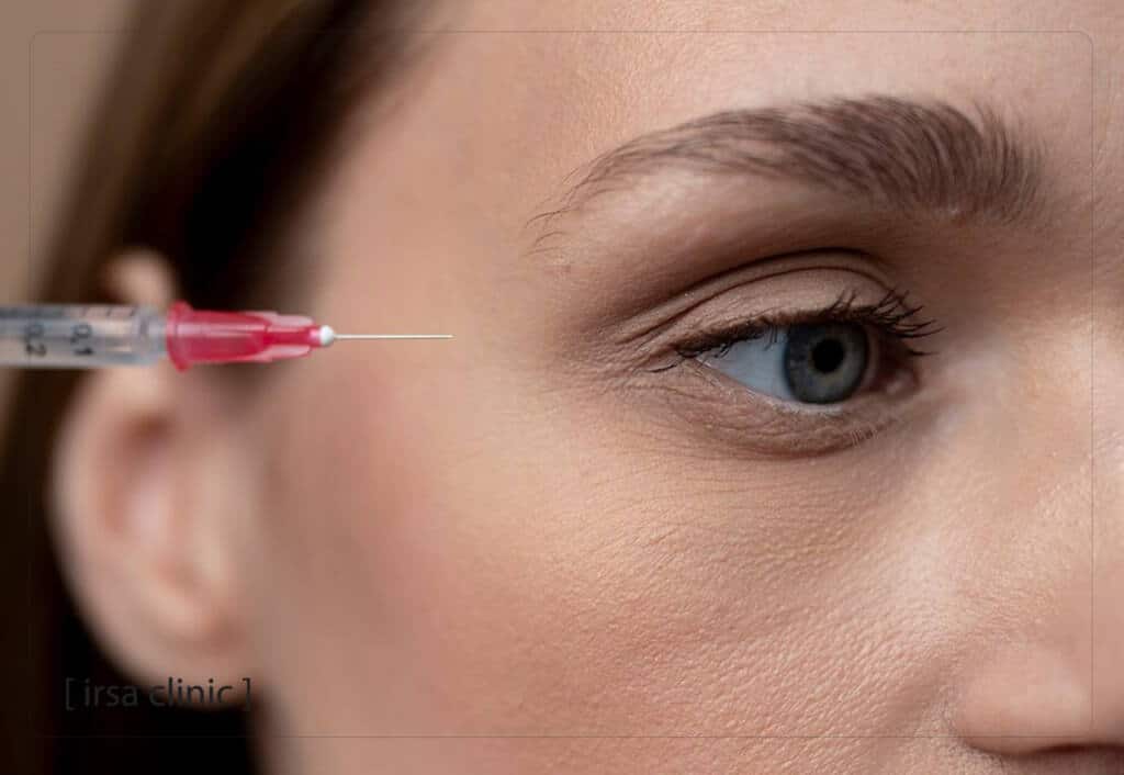  Botox cat eye lift features