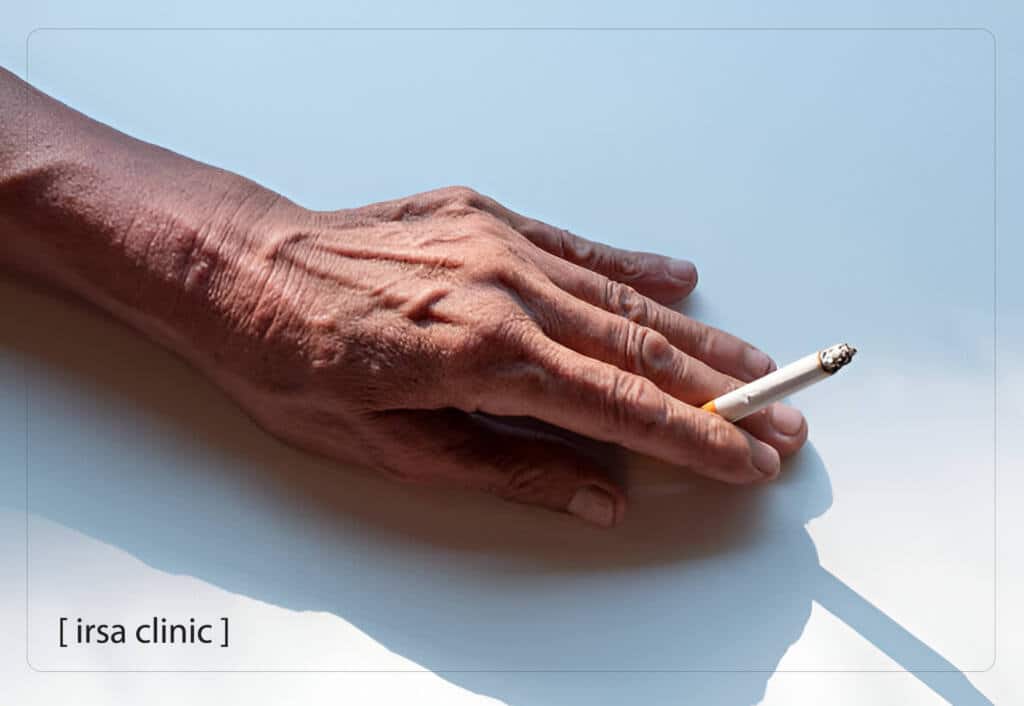 How does smoking lead to premature aging?