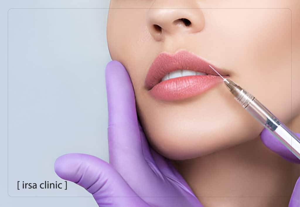 تزریق فیلر در شیراز برای ورزشکاران؛ چگونه ماندگاری را افزایش دهیم؟