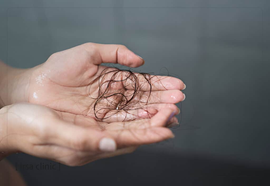مقارنة علاج العلاج بالإكسوزوم  مع طرق علاج تساقط الشعر الأخرى