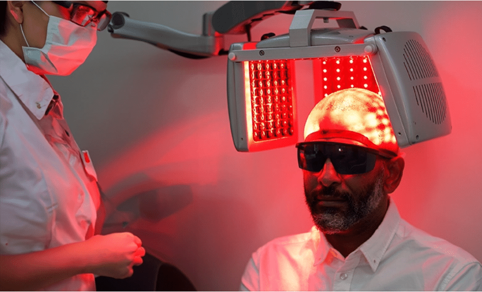 Hair Loss Laser Therapy with Low Power Laser Therapy