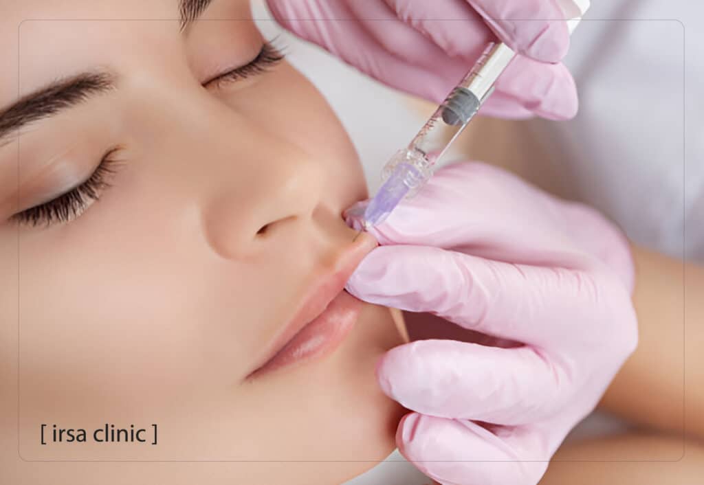 The thyroid effect on filler durability