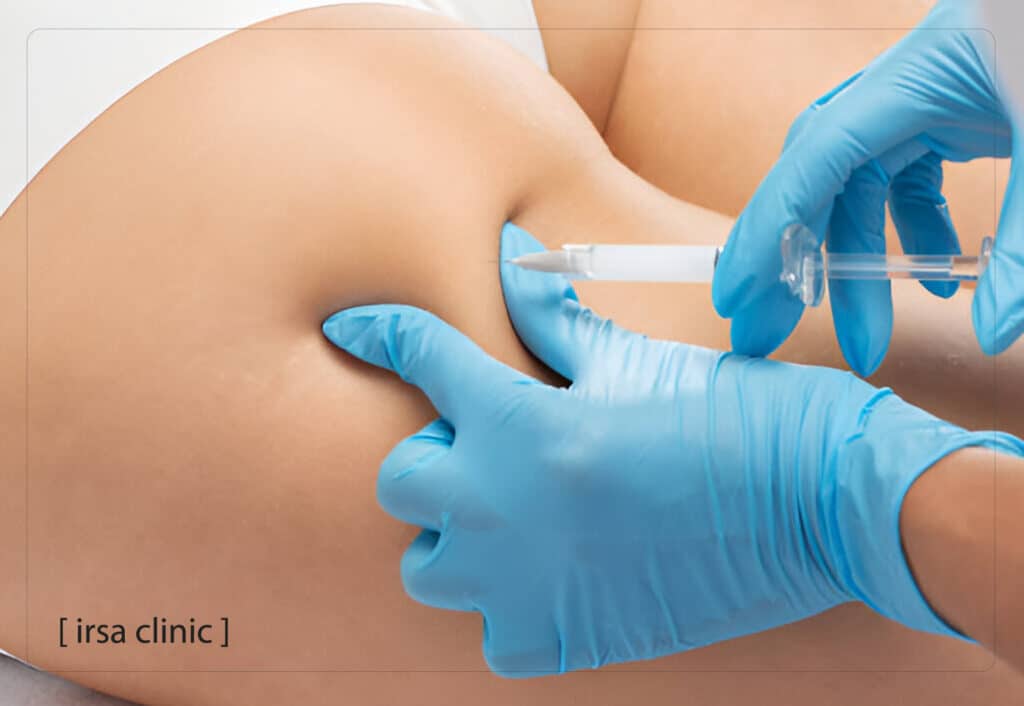 Pre-injection care for body fillers in Shiraz