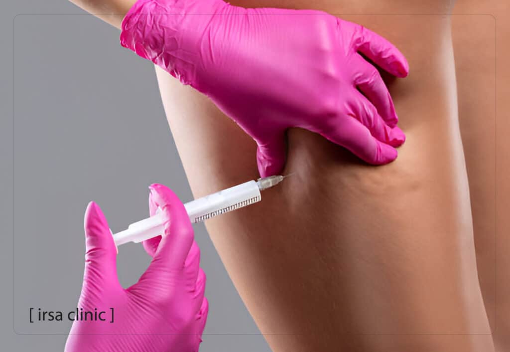 Common uses of body filler injections