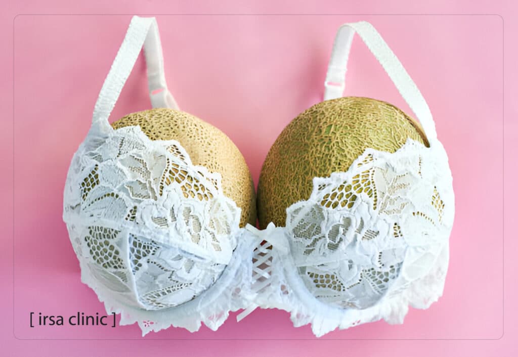 Preventing Breast Implant Bursting