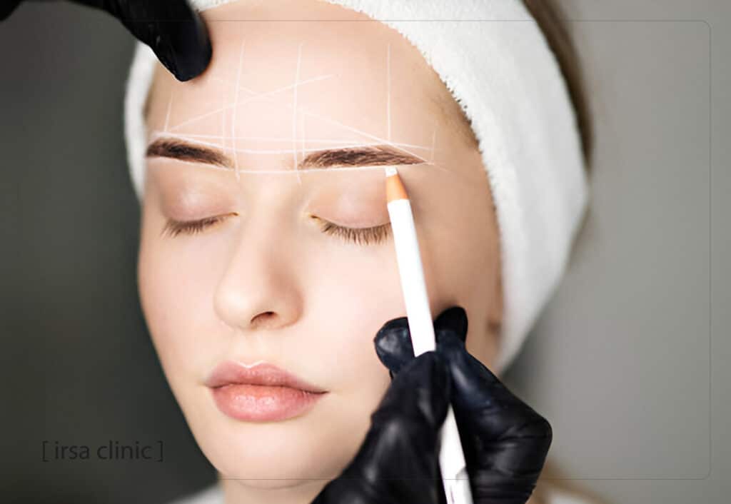 Benefits of eyebrow transplantation in Iran after cancer