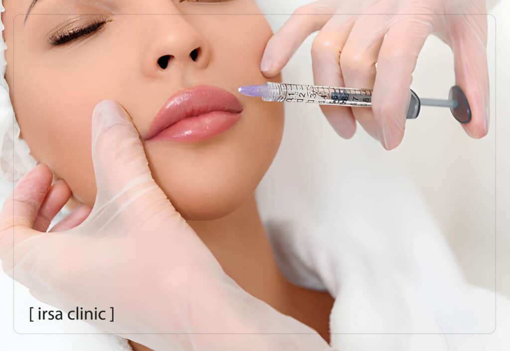 محبوبترین مدلهای تزریق ژل لب