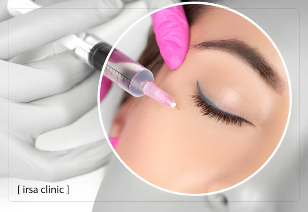 The main difference between fillers and mesogel under the eyes in Iran