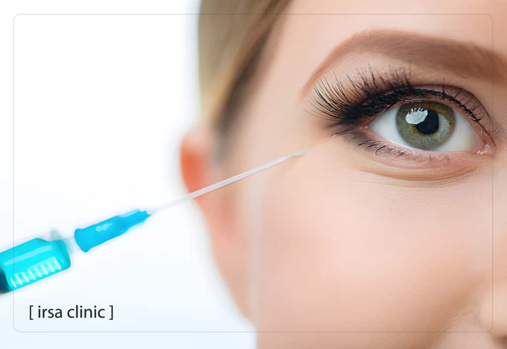 The main difference between fillers and mesogel under the eyes in Iran