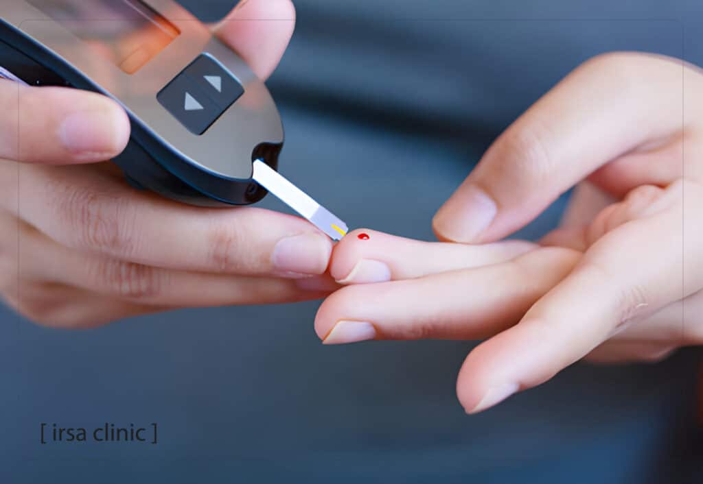 بهترین کلینیک کاشت مو در شیراز