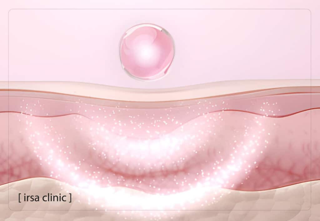 Proven benefits of Exosome therapy for skin in Shiraz