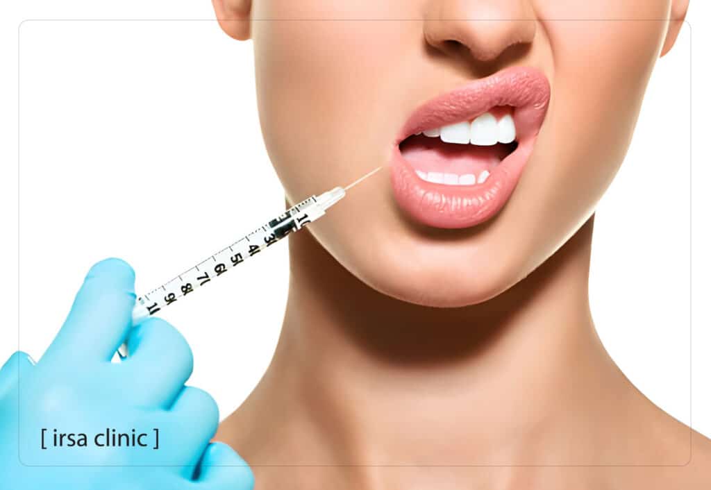 Introducing the best lip filler injection doctor in Shiraz