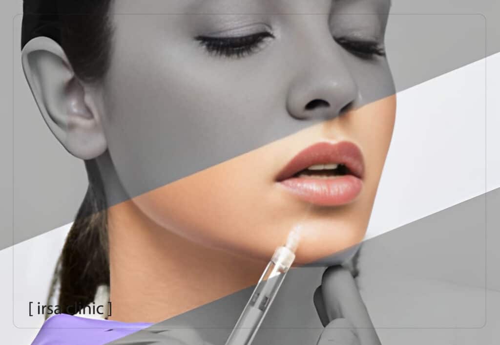 Are there any complications with lip filler injections?