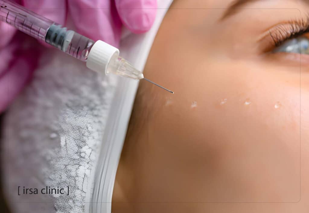  PLLA چیست و چه تفاوتی با PDLLA دارد؟