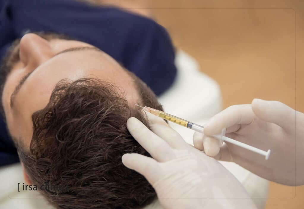 اگزوزومتراپی مو در شیراز برای کاشت مو