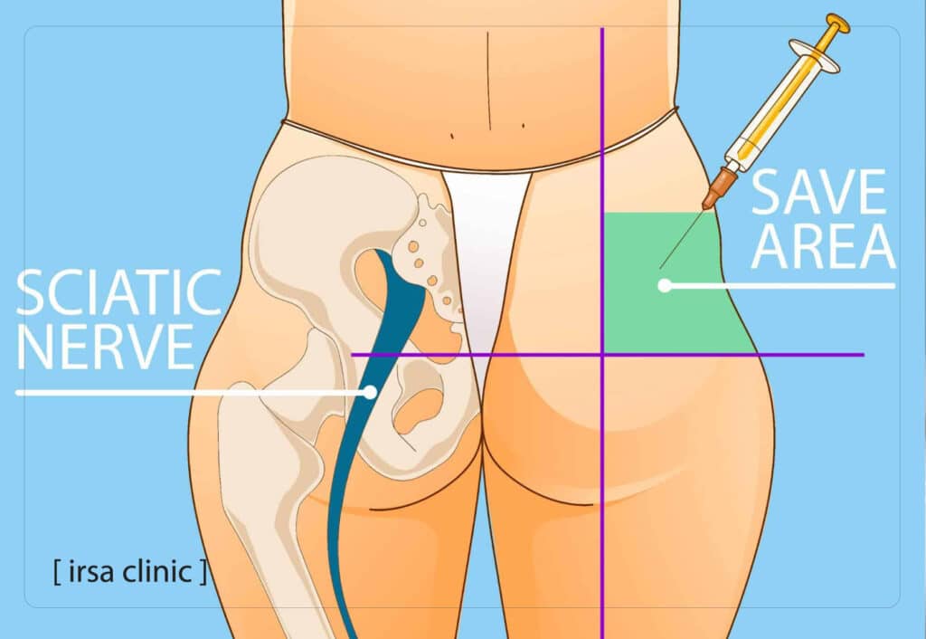 بهترین کلینیک تزریق فیلر هیپ دیپ در شیراز