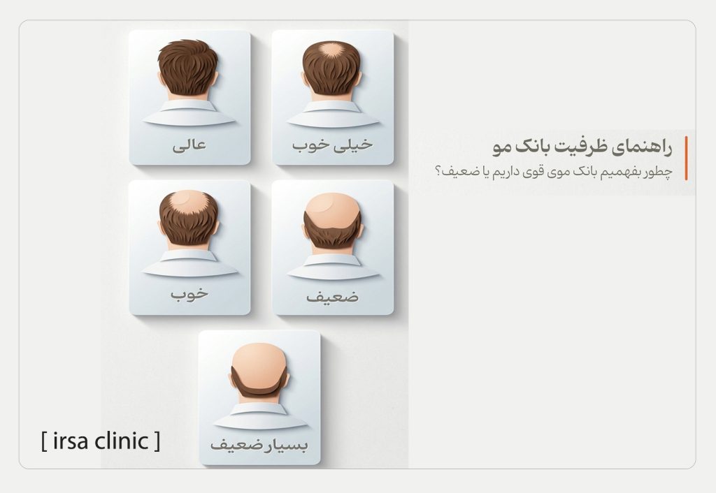 آیا بانک موی مناسبی برای کاشت مو دارم؟