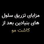 تزریق SVF یا سلول بنیادین بعد از کاشت مو؛ آیا این روش میتواند به نتیجه بهتر کاشت مو کمک کند؟