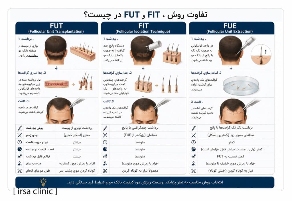 تفاوت روش FUT و FIT و FUE در کاشت مو چیست؟